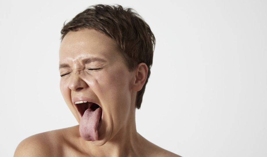 Hongos debajo de la lengua: ¿por qué salen? (síntomas, causas y qué hacer)